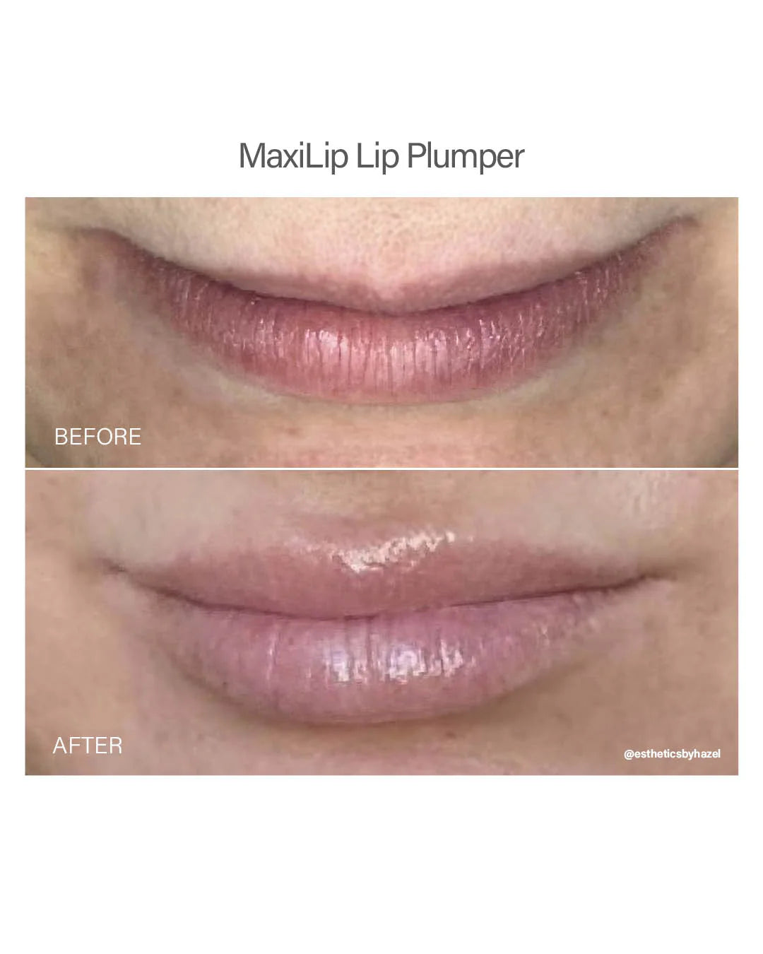 Vivant Skin Care Maxilip Lip Plumper