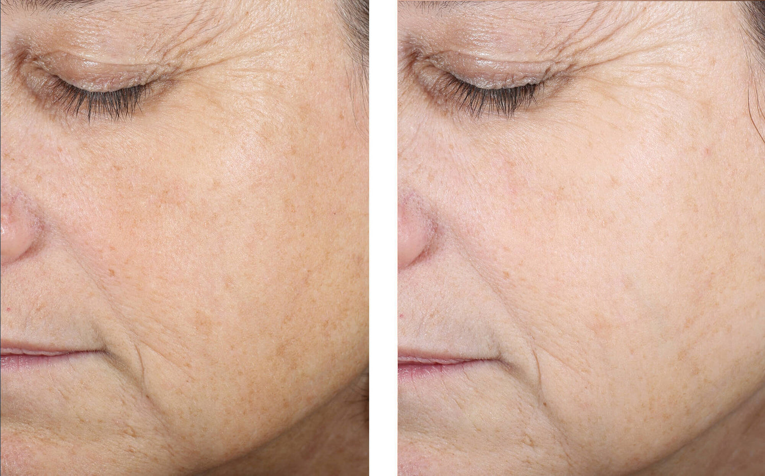 Skin Better Science Even Tone Correcting Serum