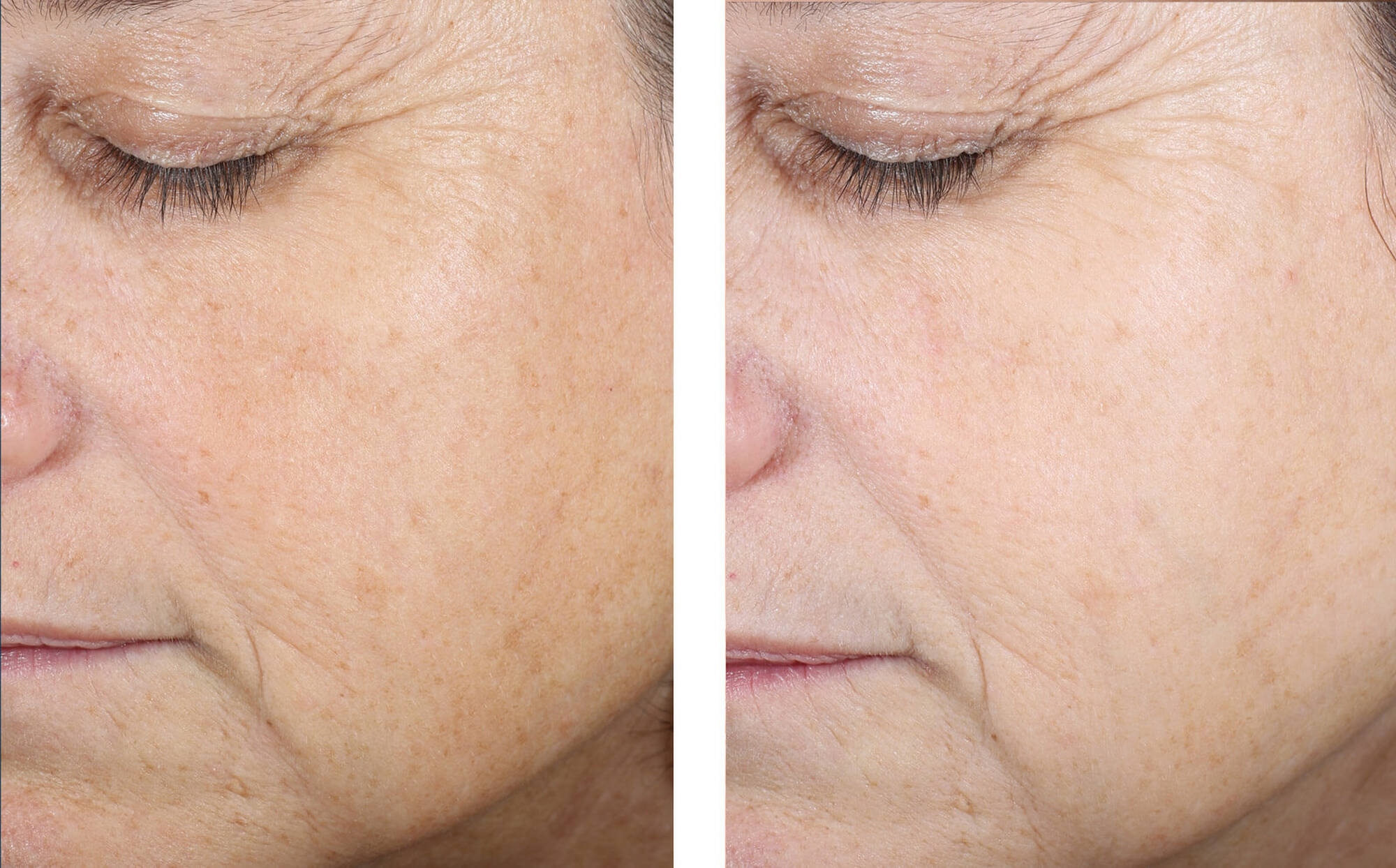 Skin Better Science Even Tone Correcting Serum