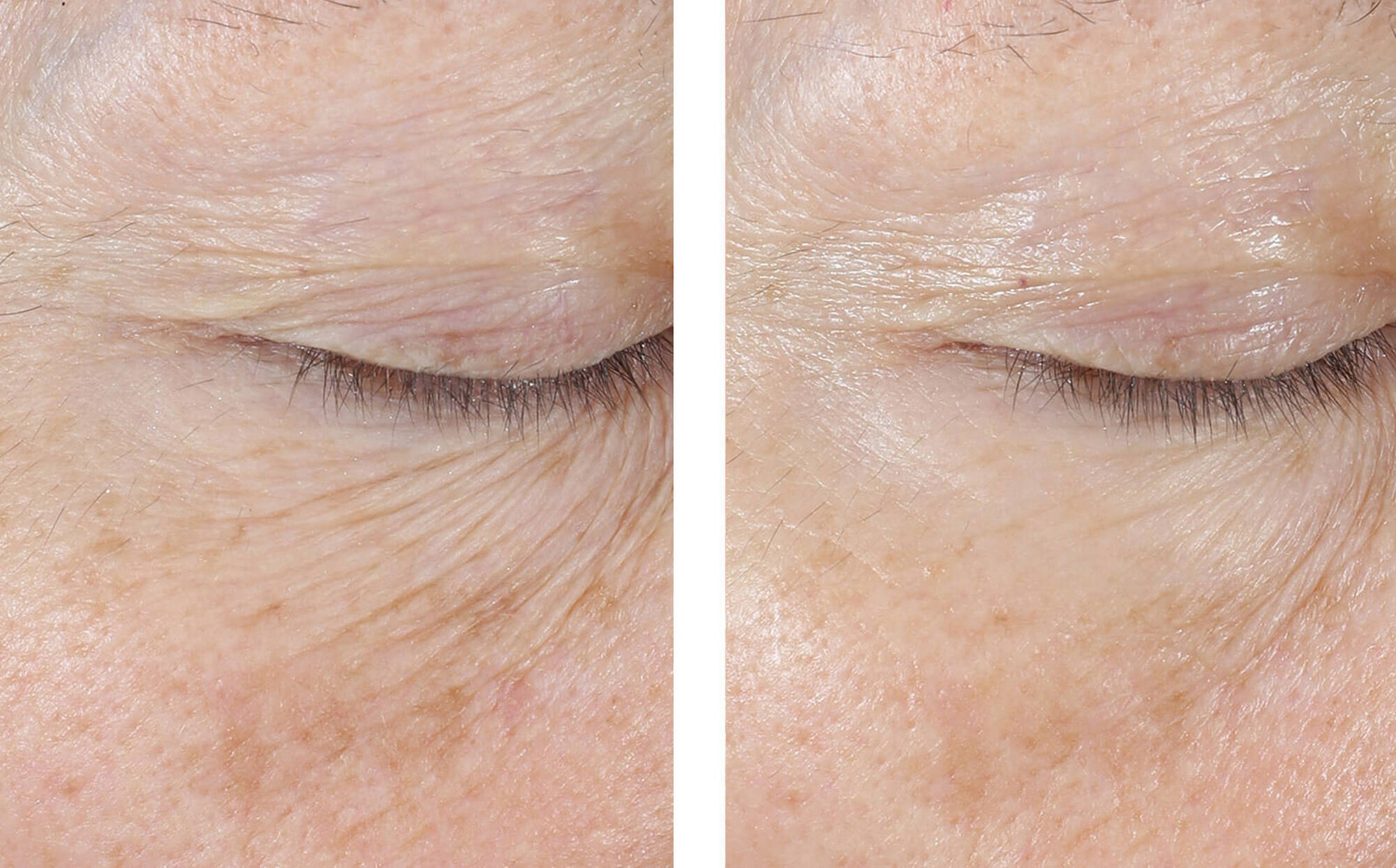 SkinBetter Science InterFuse Treatment Cream EYE