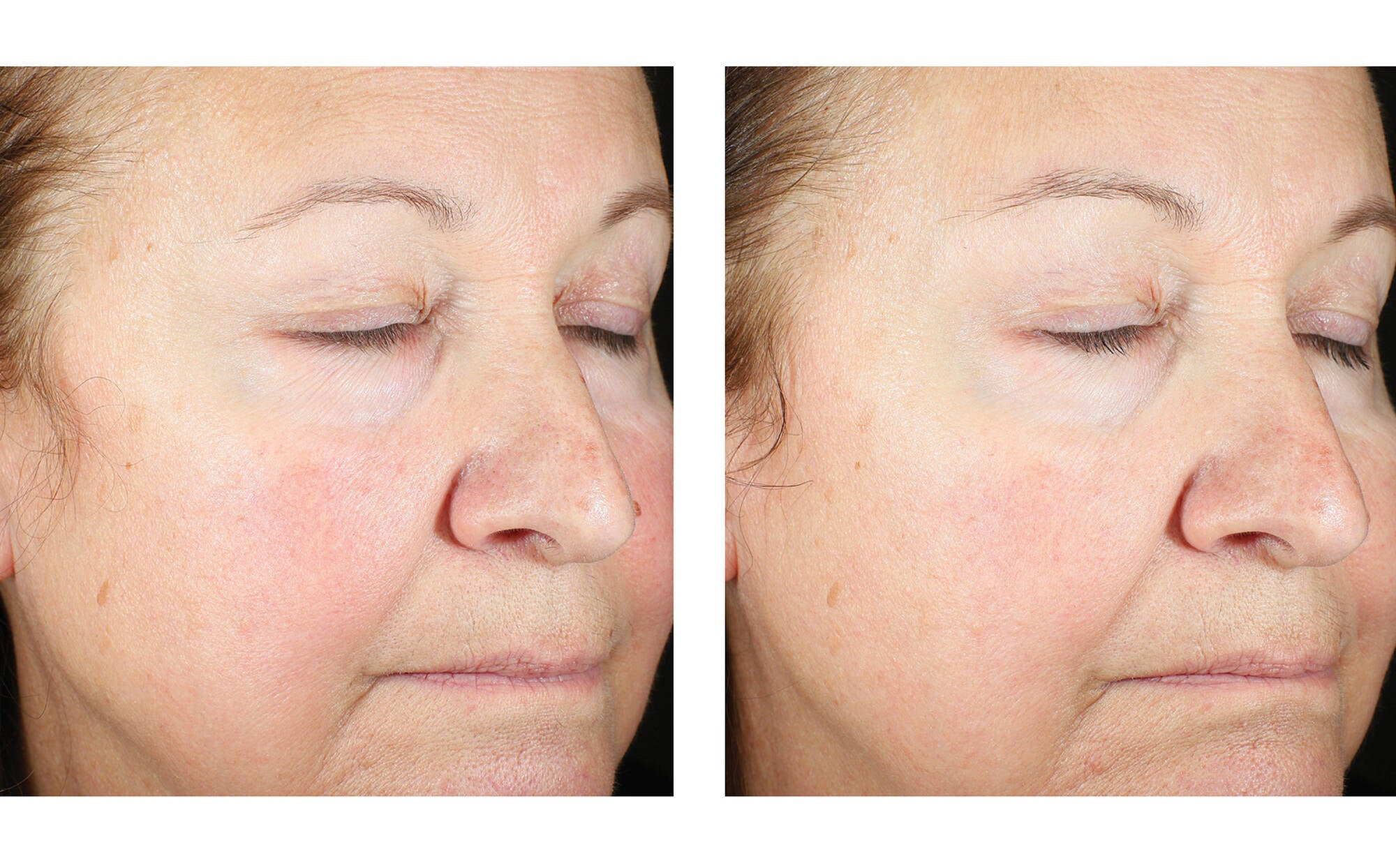 SkinBetter Science Trio Luxe Moisture Treatment