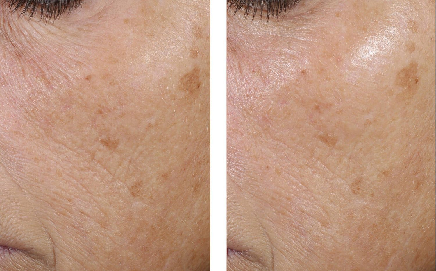 SkinBetter Science Trio Rebalancing Moisture Treatment