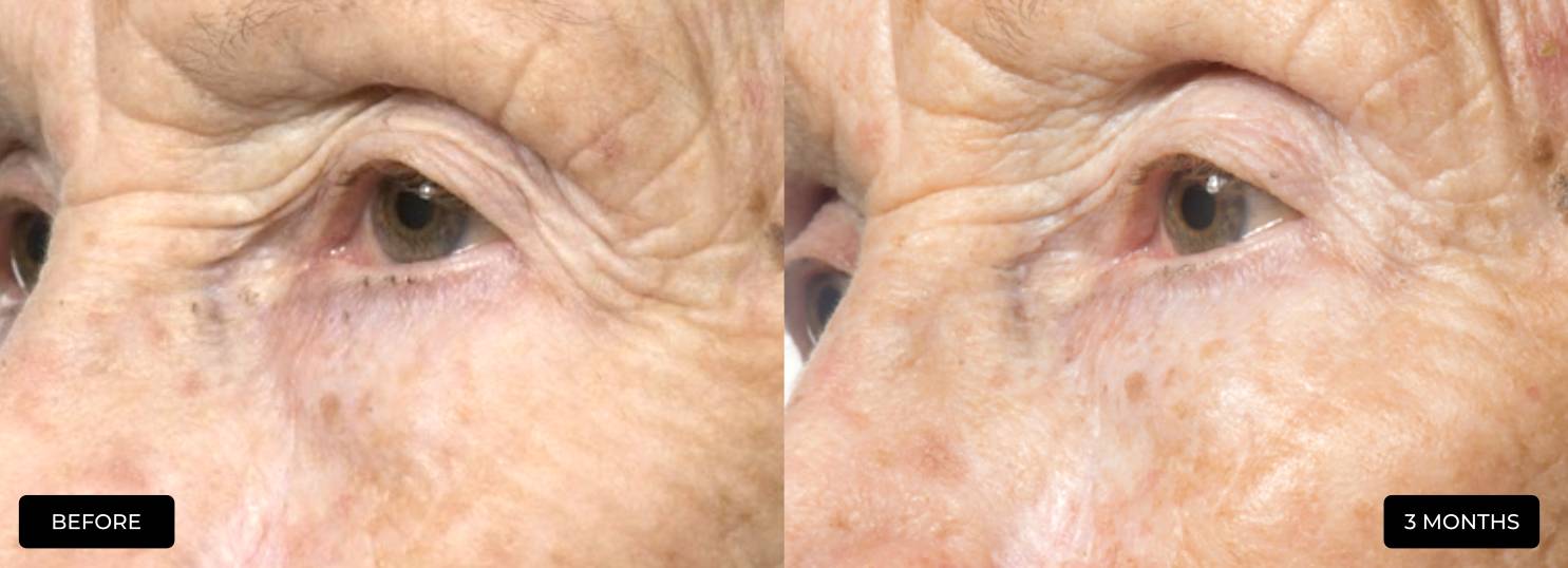 The Skin Diary Night Repair Cream