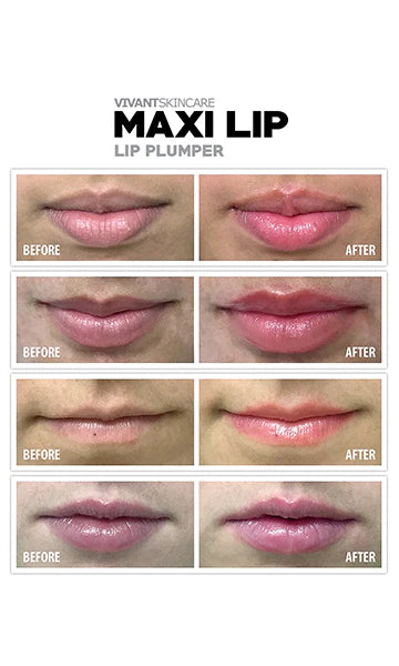 Vivant Skin Care Maxilip Lip Plumper