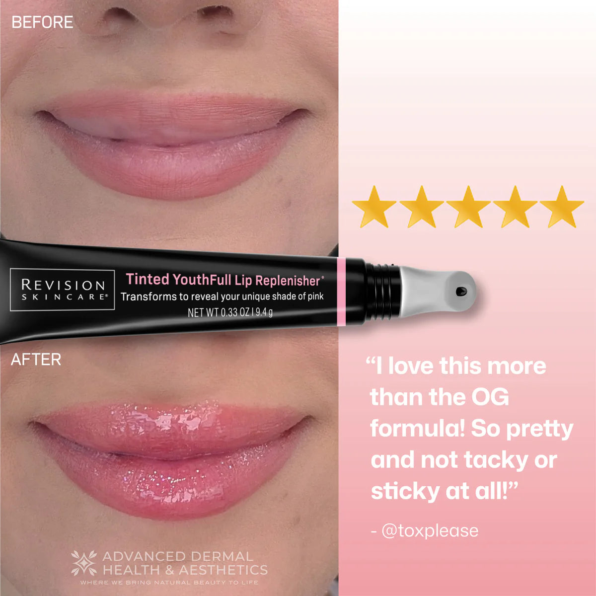 Revision Skincare Youthful Lip Replenisher Tinted