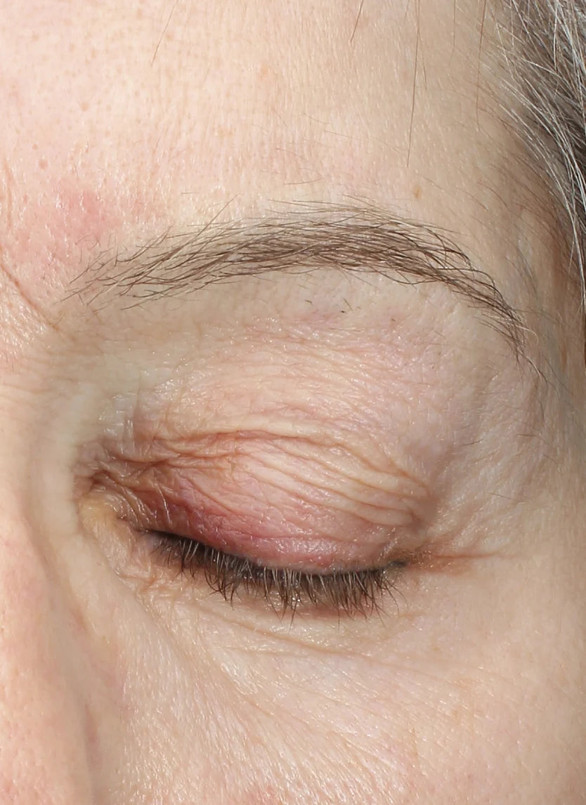 Calecim Professional Eye Contour Lifting Cream