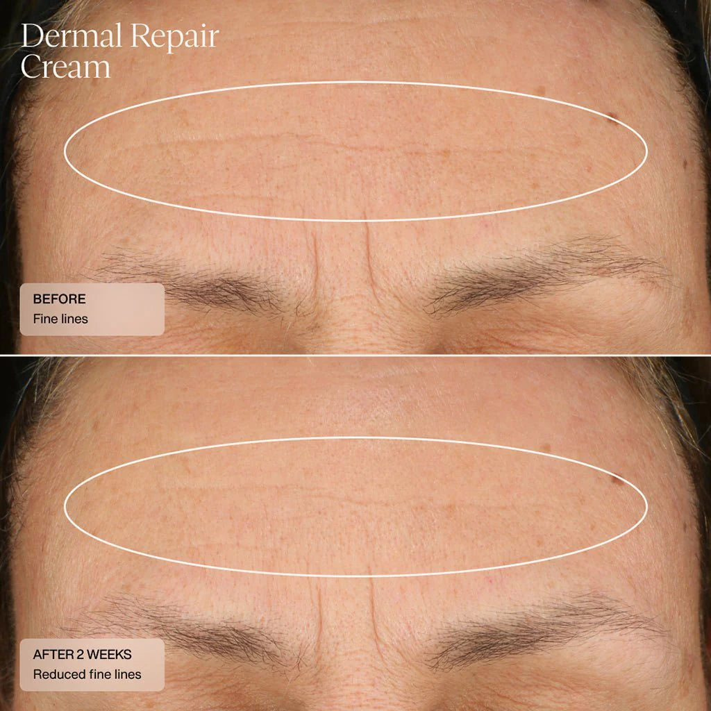 Senté Dermal Repair Cream